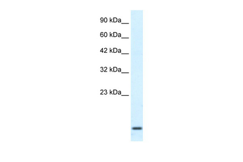 HOXA1 Rabbit Polyclonal Antibody