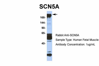 SCN5A Rabbit Polyclonal Antibody