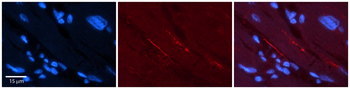 SCN5A Rabbit Polyclonal Antibody