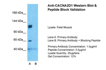 CACNA2D1 Rabbit Polyclonal Antibody