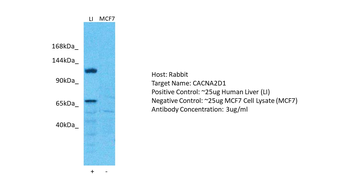 CACNA2D1 Rabbit Polyclonal Antibody