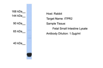 ITPR2 Rabbit Polyclonal Antibody