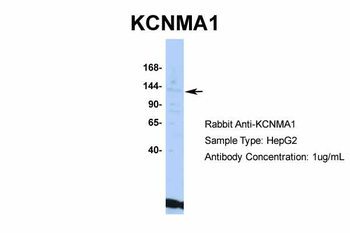 KCNMA1 Rabbit Polyclonal Antibody