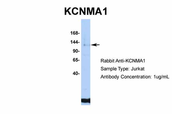 KCNMA1 Rabbit Polyclonal Antibody