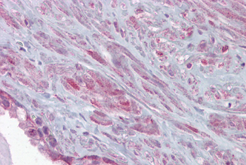 KCNMA1 Rabbit Polyclonal Antibody