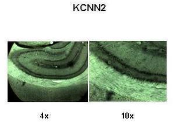 KCNN2 Rabbit Polyclonal Antibody