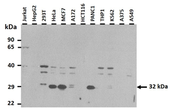 VDAC2 Rabbit Polyclonal Antibody
