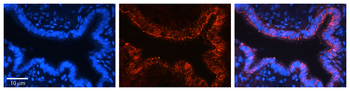 VDAC2 Rabbit Polyclonal Antibody