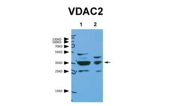 VDAC2 Rabbit Polyclonal Antibody