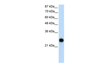 VDAC2 Rabbit Polyclonal Antibody