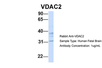 VDAC2 Rabbit Polyclonal Antibody