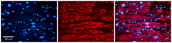 VDAC2 Rabbit Polyclonal Antibody