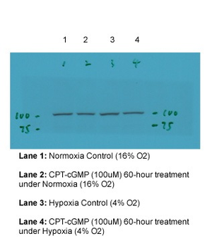 TRPC6 Rabbit Polyclonal Antibody