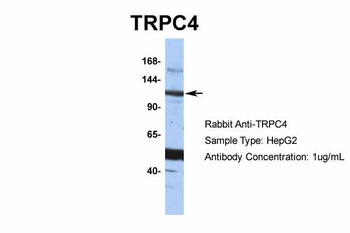 TRPC4 Rabbit Polyclonal Antibody