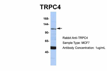 TRPC4 Rabbit Polyclonal Antibody