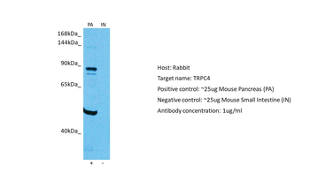 TRPC4 Rabbit Polyclonal Antibody