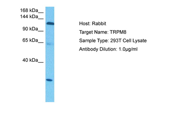 TRPM8 Rabbit Polyclonal Antibody
