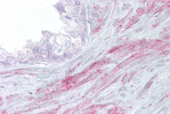 TRPM8 Rabbit Polyclonal Antibody