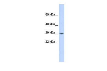 KCNN2 Rabbit Polyclonal Antibody