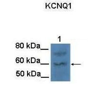 KCNQ1 Rabbit Polyclonal Antibody