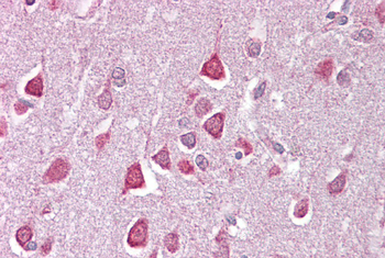 CACNA1G Rabbit Polyclonal Antibody