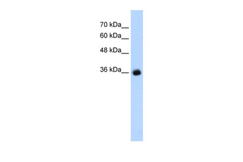GABRG2 Rabbit Polyclonal Antibody
