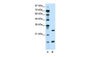 CEBPG Rabbit Polyclonal Antibody