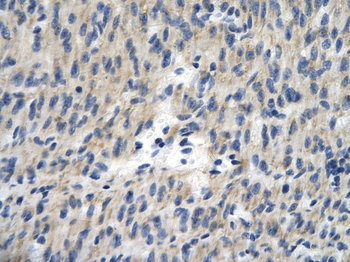 TCEAL1 Rabbit Polyclonal Antibody