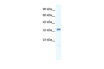 ANKZF1 Rabbit Polyclonal Antibody