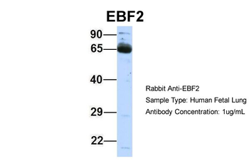 EBF2 Rabbit Polyclonal Antibody