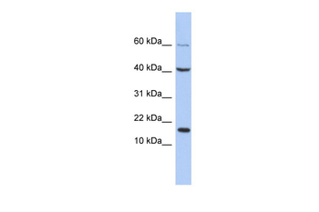 ATOH7 Rabbit Polyclonal Antibody