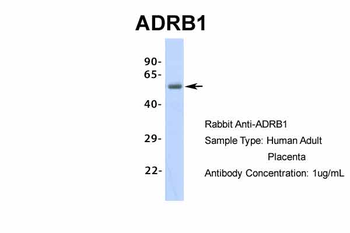 ADRB1 Rabbit Polyclonal Antibody