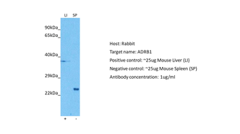 ADRB1 Rabbit Polyclonal Antibody