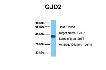 GJD2 Rabbit Polyclonal Antibody