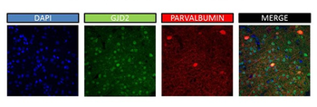 GJD2 Rabbit Polyclonal Antibody