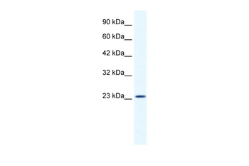 KCTD11 Rabbit Polyclonal Antibody