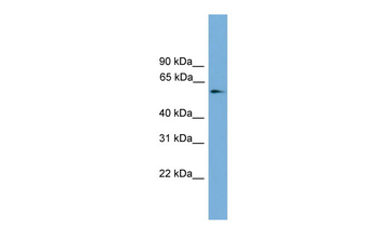 Foxc1 Rabbit Polyclonal Antibody