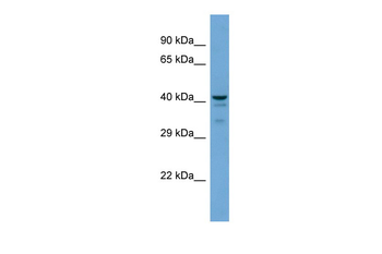Ptges2 Rabbit Polyclonal Antibody