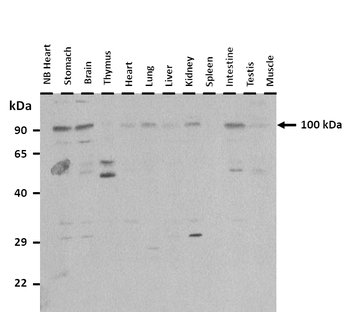 E2F7 Rabbit Polyclonal Antibody