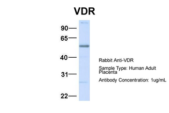VDR Rabbit Polyclonal Antibody