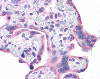WT1 Rabbit Polyclonal Antibody