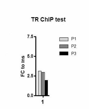 THRB Rabbit Polyclonal Antibody