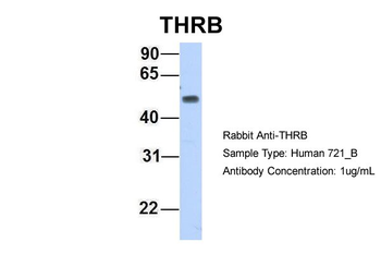 THRB Rabbit Polyclonal Antibody