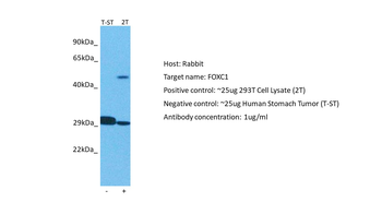 FOXC1 Rabbit Polyclonal Antibody