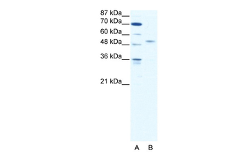 IRF5 Rabbit Polyclonal Antibody