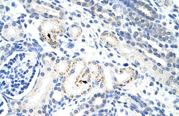 MYC Rabbit Polyclonal Antibody