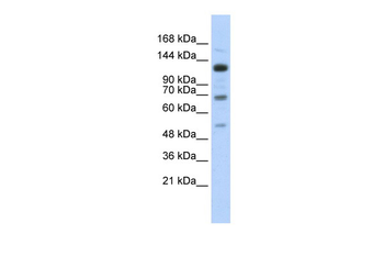 RFX1 Rabbit Polyclonal Antibody