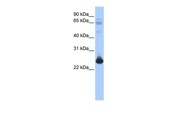 TCEAL1 Rabbit Polyclonal Antibody