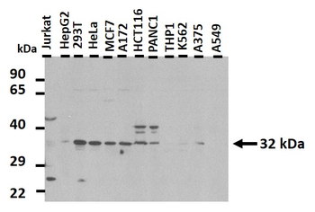 PITX3 Rabbit Polyclonal Antibody