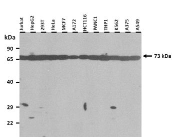 SIM2 Rabbit Polyclonal Antibody